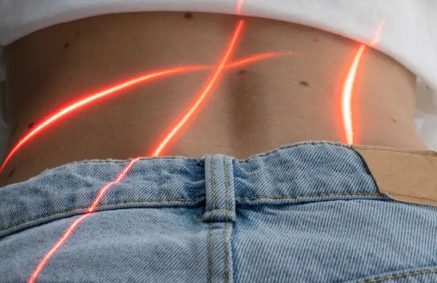 laserterapia que es