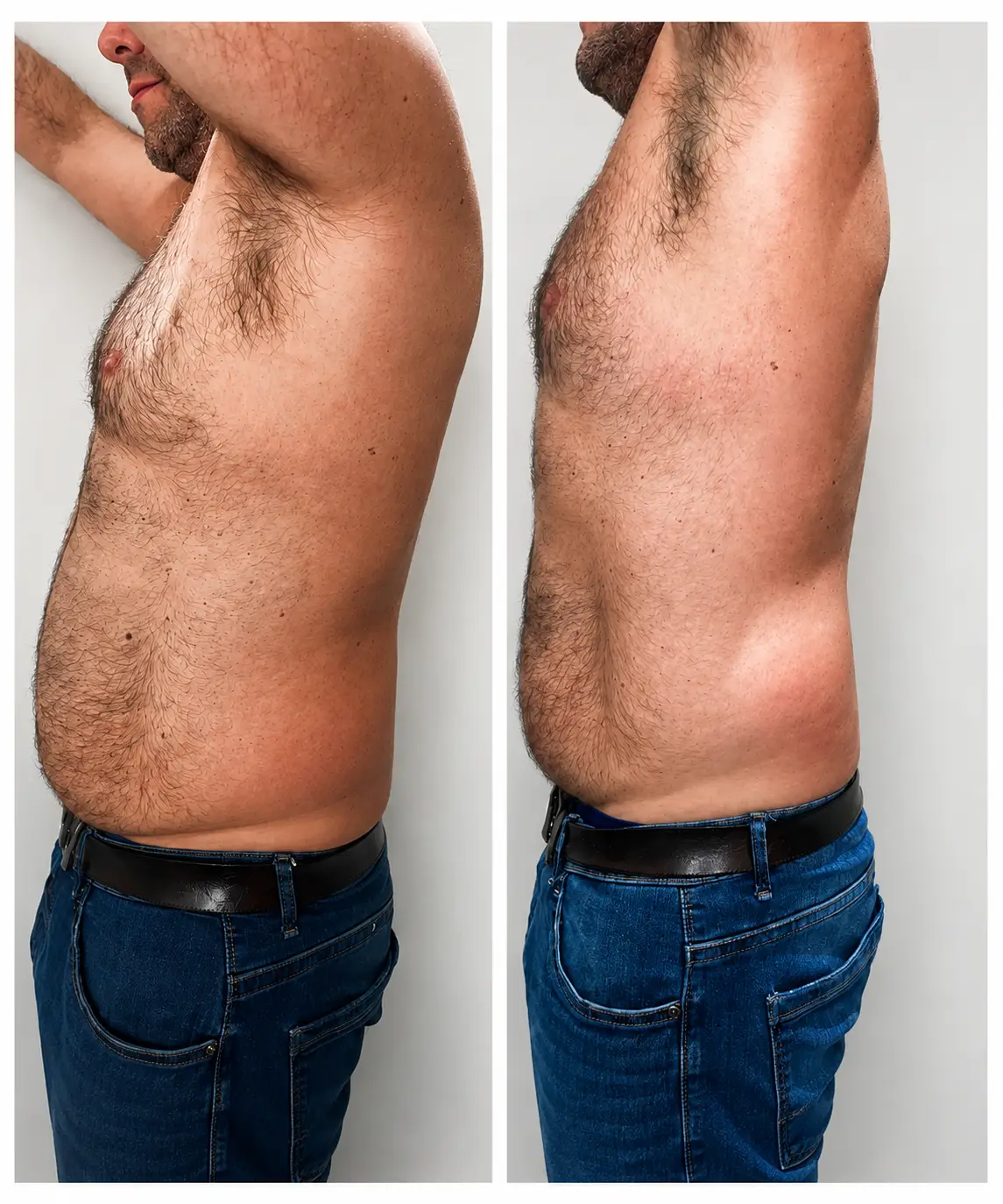 img-clinicalasermoral-emerald-antes-despues-3